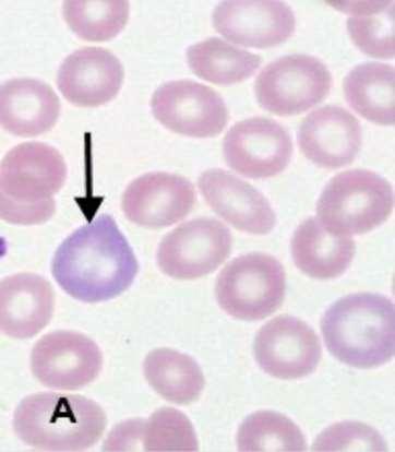 On a blood smear stained with Wright-Giemsa, reticulocytes appear larger than mature RBCs