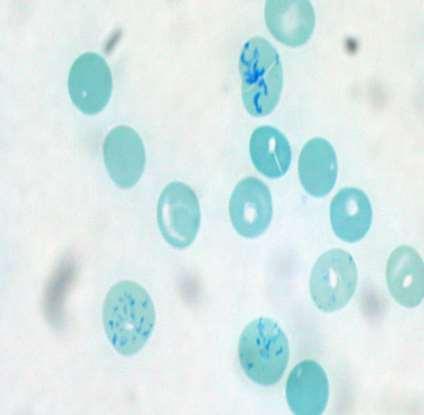 If supravital staining (new methelene blue) is performed on a blood smear, the