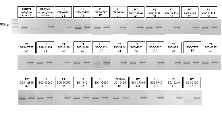 MGMT Promoter Methylation Can Be Determined by PCR-based Tests Performed on Paraffinized Tissue