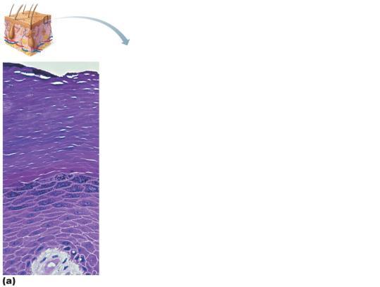 Layers of the Epidermis in Thick Skin Thin skin lacks lucidum, other strata thinner Stratum corneum Most superficial layer; 20 30 layers of dead cells, essentially flat membranous sacs filled with