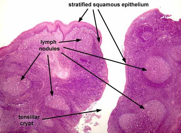 14 Histology of Peyer's patches Small accumulations of lymphocytes or solitary lymph follicles are found scattered in beneath the epithelium throughout the gastrointestinal tract.