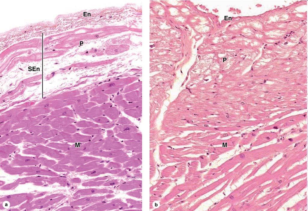 Endocardium A single layer of squamous endothelial cells Thin layer of loose connective tissue: elastic &