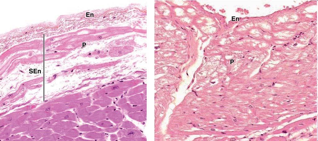 Distal fibers of AV bundles: larger than ordinary cardiac muscle fibers conducting myofibers or Prukinje fibers 1 or 2 nuclei cytoplasm: rich in mitochondria, glycogen myofibrils:
