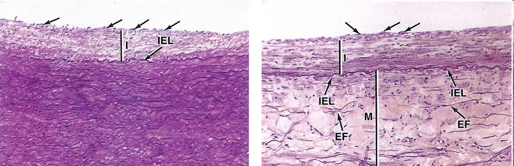 tissue smooth muscle found in In arteries: internal elastic lamina most