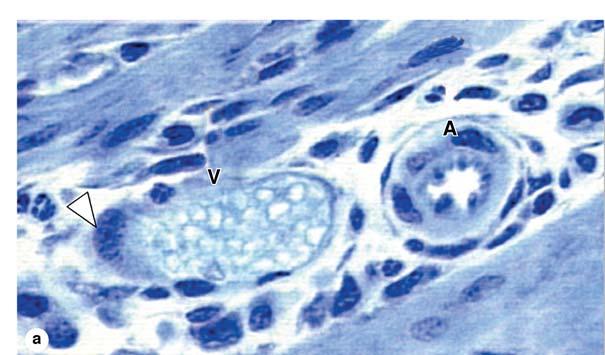 Venules Transition from capillaries to venules: gradually Postcapillary venules: similar structurally to capillaries with pricytes