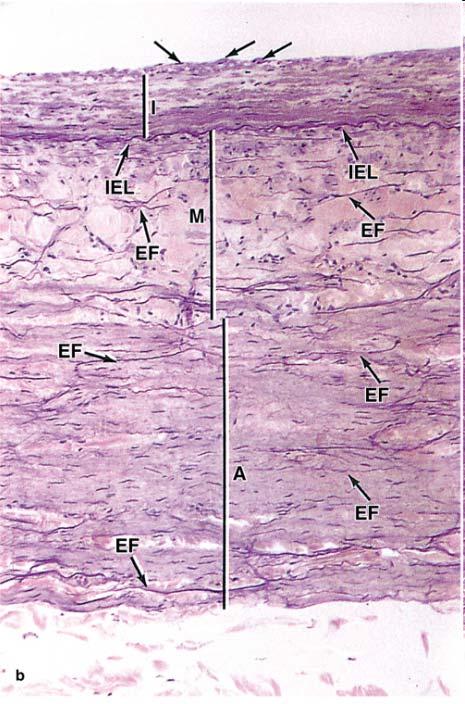 Big venous trunks, paired with elastic arteries: large veins Well developed intima Media: relative thin few layers of smooth muscle cells abundant connective tissue