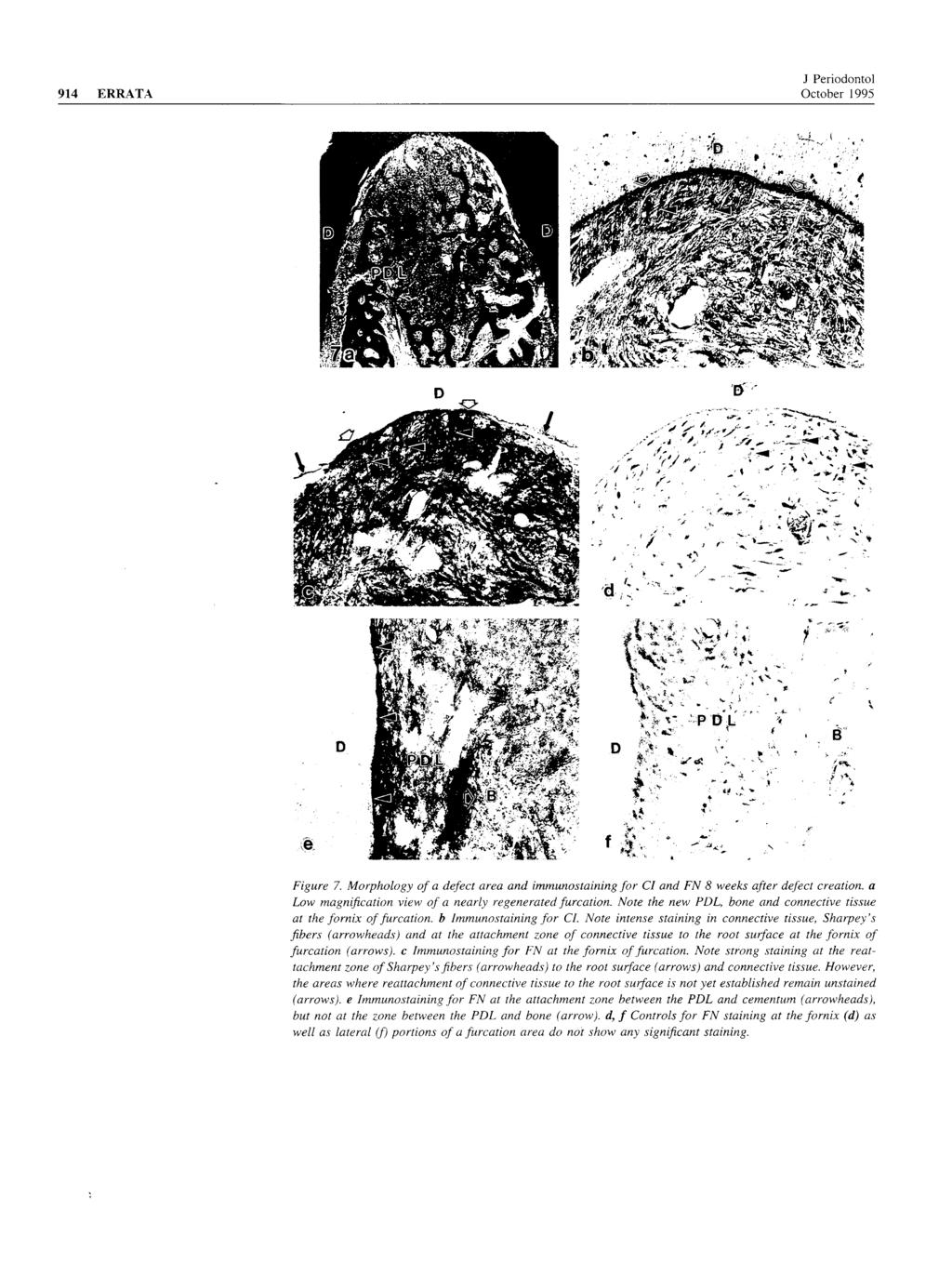 914 ERRATA J Periodontol October 1995 Figure 7. Morphology of a defect area and immunostaining for CI and FN 8 weeks after defect creation, a Low magnification view of a nearly regenerated furcation.