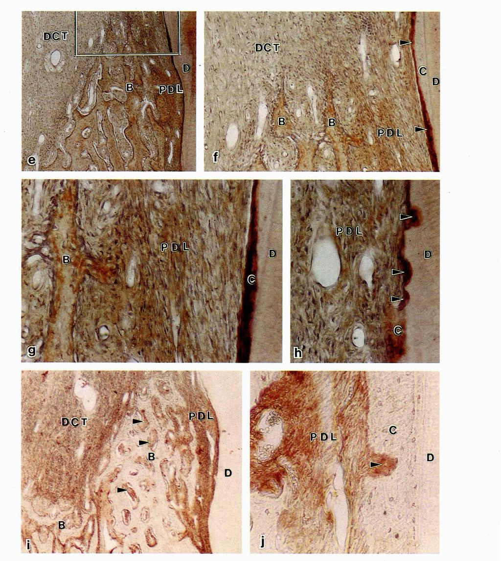 f, g Note staining in new cementum (C) (arrowheads), moderate staining in PDL and new bone, but weak staining in dense connective tissue