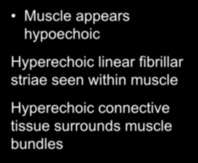 Muscle Imaging on Ultrasound Muscle appears