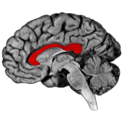 cortex Contralateral processing Cut corpus collasum Brain hemispheres connected