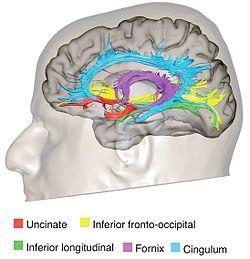 White matter of the cerebral cortex Corpus callosum and anterior commissure are the primary white