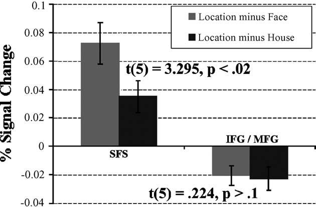 J.B. Sala et al. / Neuropsychologia 41 (2003) 341 356 351 MFG, were more active during object delays than during spatial delays.