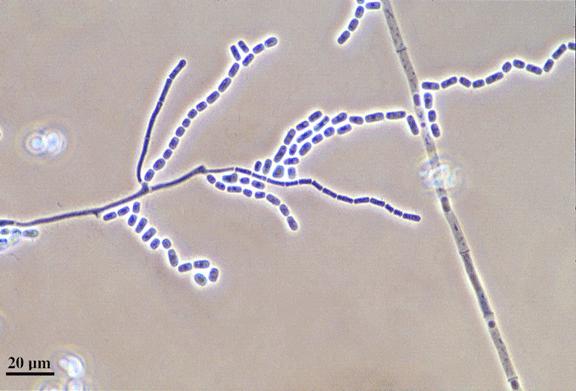 Microscopy Photo from Mycology Online Geotrichum candidum- Course true hyphae (no pseudohyphae)