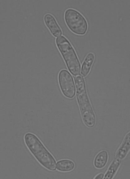 Microscopy Pseudohyphae Candida kefyr elongated blastoconidia