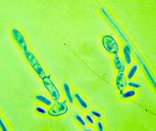 Conidia gather in clusters at the end, sides of conidiophore and at points along the hyphae.