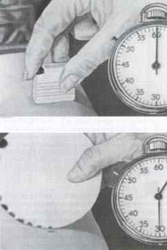 Bleeding time test Timer is started upon incision Bleeding time