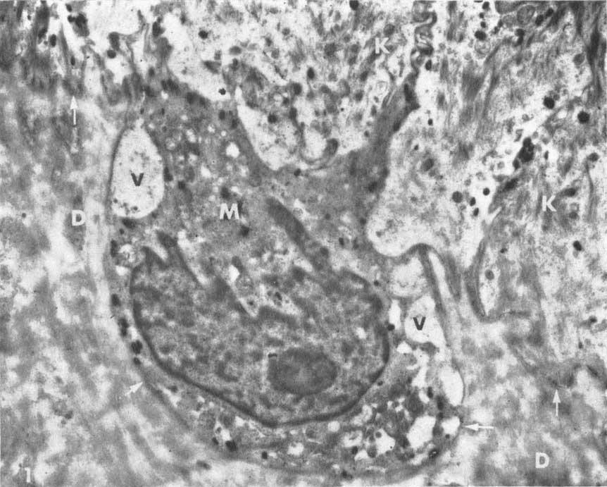 cytoplasmic ratio was high. Mitochondria were generally numerous. The cytoplasmic granules contained in these cells (Figs.