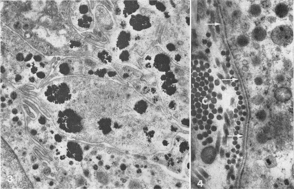Inset: Portion of another cell at the same magnification to show outside granule of Type :0 2. a r*'aa,zw'-& t. I; S.,S. FIG. 3.