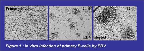 Cultured Cell Lines: An Industry Norm Useful for Tox screens and 1st look&-see Scant Relevance to