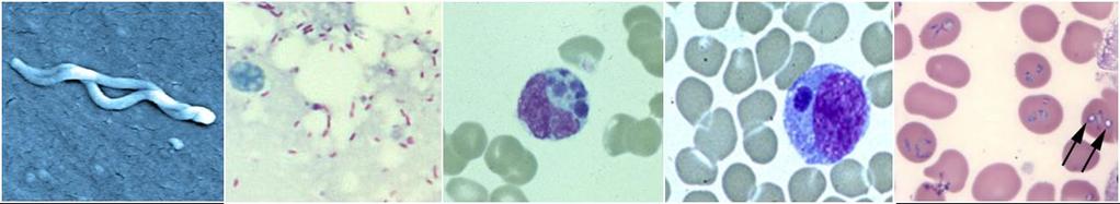 Tick-associated diseases in the United States Anaplasmosis Babesiosis