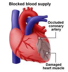 High blood pressure Damage to heart valves Diabetes High