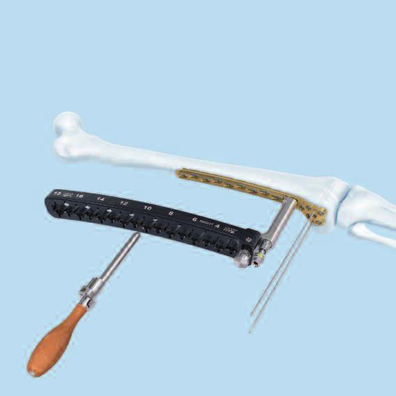 Plate Insertion and Aiming Arm Attachment Note: For clear visualization, soft tissue is not shown in the following steps. 5 Insert trocar 1 Instruments 03.120.015 Trocar with Handle for No. 03.120.014 03.
