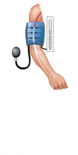 21a Pressure in cuff above 120; no sounds audible Rubber cuff inflated with air 120 mm Hg Brachial artery closed (b) The blood pressure cuff is