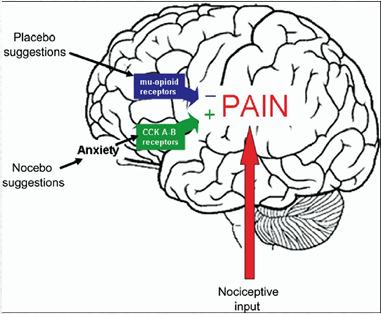 STEP 8: Understanding chronic pain Perception of Pain The Pain Receptors stop working Opioid Induced Hyperalgesia diffuse pain