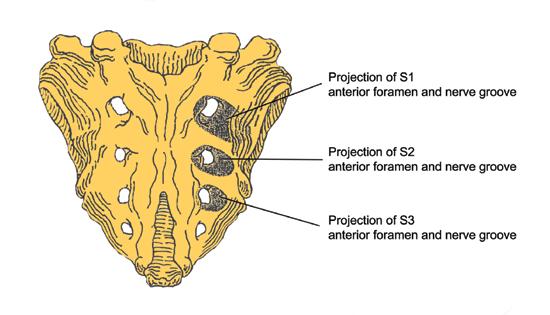 Figure 6. Dorsal aspect of sacrum (specimen). Figure 8. Two-plate placement extending to S2 region by removal of partial posterior ilium. A C Figure 9.