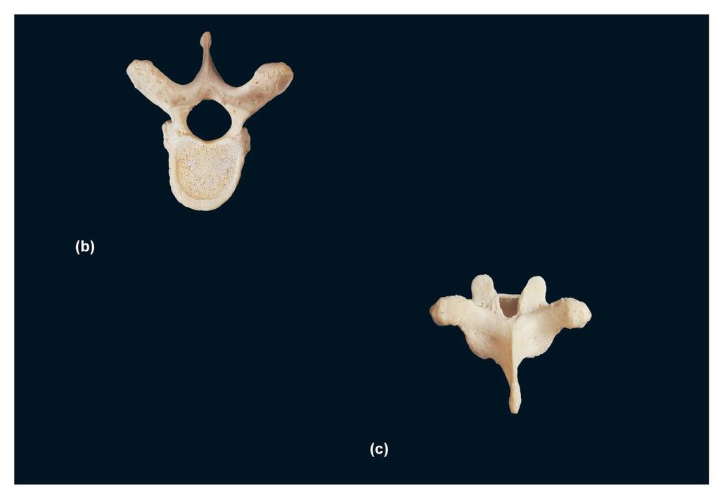FIGURE 20B C Lamina Superior Superior costal facet (for head of rib) Body Spinous Vertebral foramen seventh (typical) thoracic vertebra, superior view