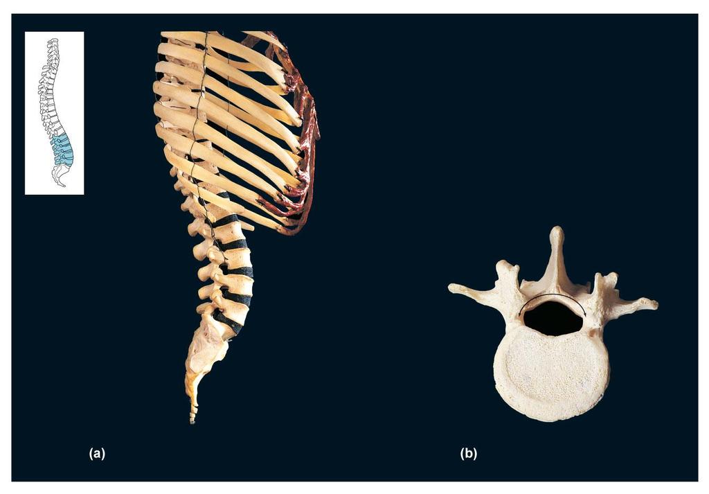 FIGURE 21A B True ribs Lumbar vertebrae L1 L2 L3 L4 L5 False ribs Intervertebral discs Superior Lamina Pedicle Inferior Spinous