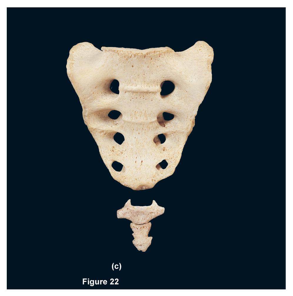 FIGURE 22C Base (superior part) Ala Sacral promontory Body of first sacral vertebra ridges