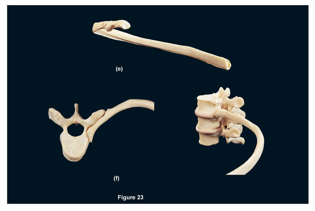 FIGURE 23E F Neck of rib Angle of rib Costal groove Tubercle of rib Head of rib Shaft of rib typical left rib, medial view Sternal end costal facet (for tubercle of rib) Spinous Angle of rib Shaft