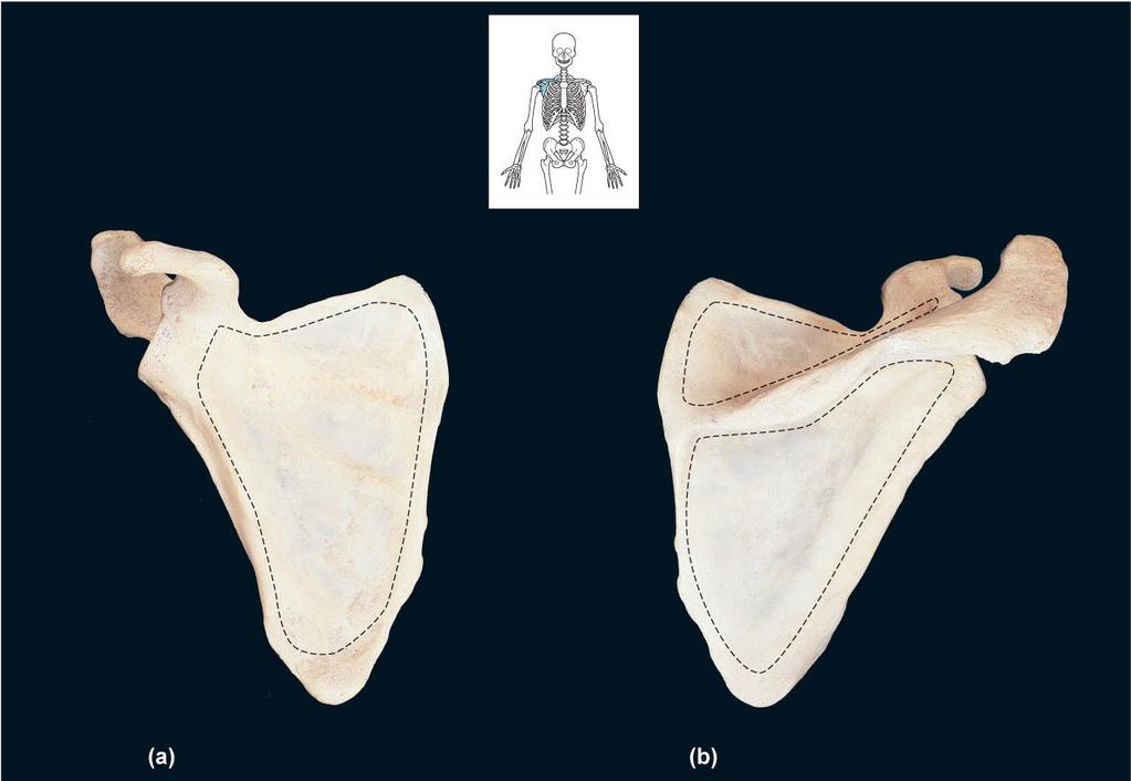 FIGURE 24A B Acromion Coracoid Glenoid cavity Lateral angle Subscapular fossa Lateral border Suprascapular notch Superior border Superior angle Medial border Inferior angle right scapula, anterior