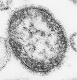 Morbilivirus Closely related to rinderpest (cattle) and canine distemper viruses (CDV), suggesting that measles might have evolved from