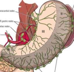 The Stomach: Lymph drainage Arranged into 4 zones i. Zone I (inferior gastric) drains into the subpyloric and omental nodes ii. Zone II (splenic) drains into the pancreaticosplenic nodes iii.