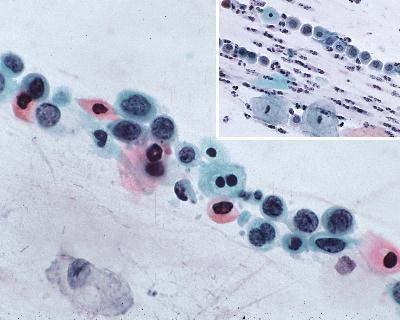 on all types of cytological