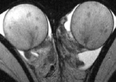 OVERVIEW THIS FOUR DAY COURSE is designed for the general radiologist. We will review the diagnostic imaging evaluation of common tumors, including head and neck, thoracic, and abdominal malignancies.