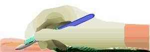 ENGINEERING CONTROLS Scalpels which contain the Hazard Re-Sheathing Disposable Scalpels Single-use disposable
