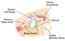 This can happen as a result of a sudden injury or from overuse. Once a shoulder has dislocated, it is vulnerable to repeat episodes.