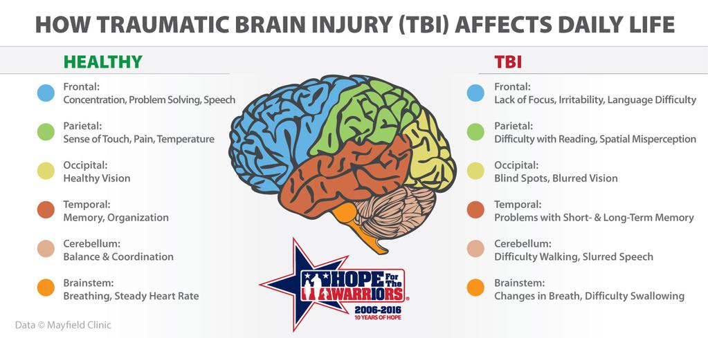 Brain injuries affect who we are, the way we think, act, and feel. It can change everything about us in a matter of seconds.