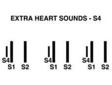 Note location, timing, intensity, pitch, and effects of respiration on the sounds Slide 32 Heart murmurs Heart murmurs are distinguishable from heart sounds by their longer duration Attributed to