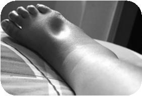each foot & leg Note relative size & prominence of veins, tendons & bones.