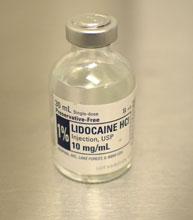 Inhalational agents Lidocaine infusions