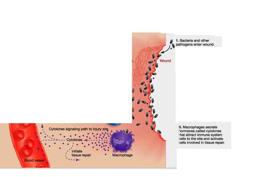 Injured cells release the chemical histamine which causes capillaries to dilate,