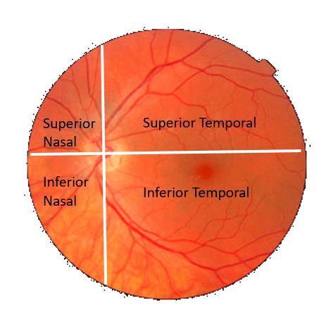 Optic disc (Blind spot) & Optic cup To view the rest of the structures move the area of illumination by adjusting head-eye-instrument inclination.
