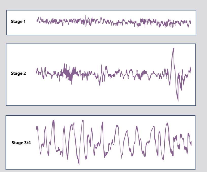 During the sleep cycle Brain waves represent