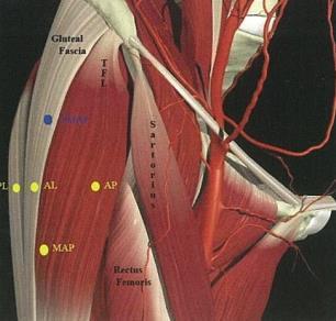 posterolateral aspects of the hip: Lateral and