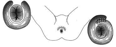 Anterior Sphincter Repair Operation How will the operation help me?