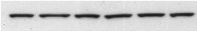 In vitro Nrf2 activation by NAPQI H N CH33 N CH 3 Nrf2 β-actin H paracetamol